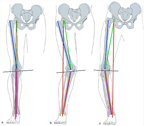 анатомия система подвески бедра